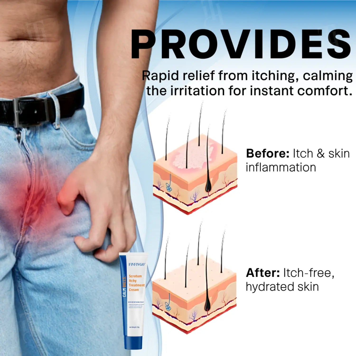 Scrotum Itchy Treatment Cream