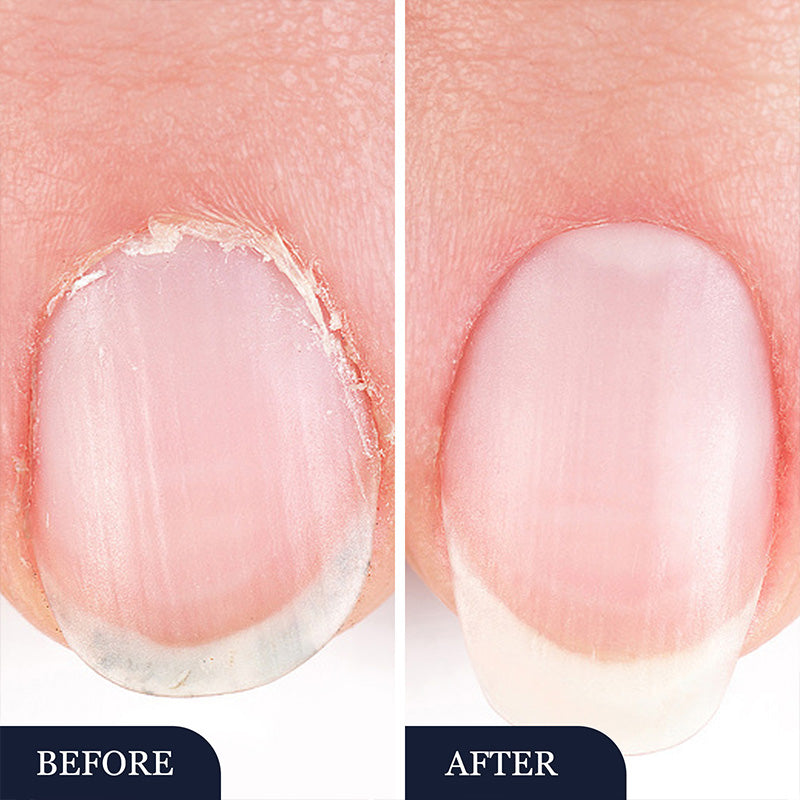 2 In 1 Anti-Fungal Nail Repair Pen